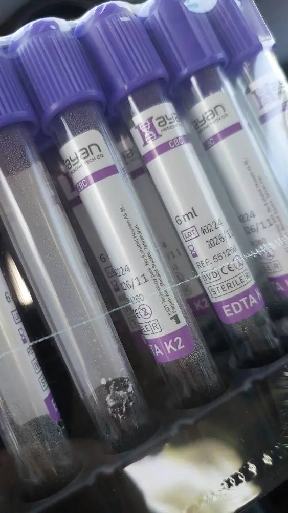 لوله خونگیری خلاء EDTA K2, 6ml 