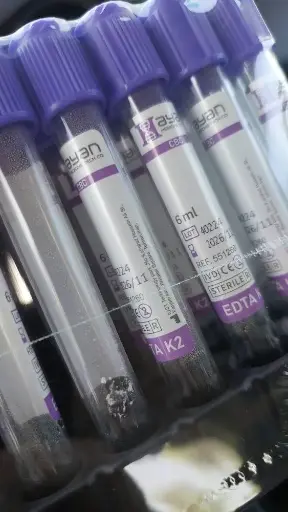 [CBC2-6ml] لوله خونگیری خلاء EDTA K2, 6ml 